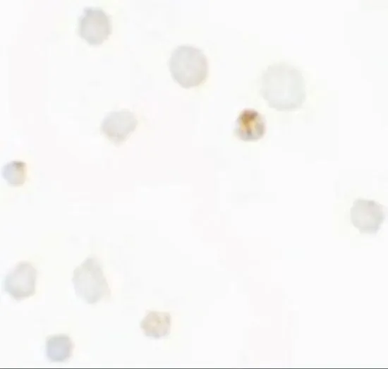 ICC/IF analysis of Raji cells using GTX31484 SEPT1 antibody. Working concentration : 5 microg/ml ICC/IF analysis of Raji cells using GTX31484 SEPT1 antibody. Working concentration : 5 microg/ml