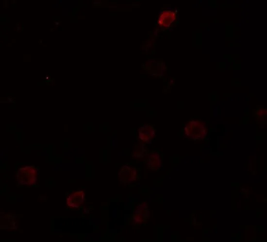 ICC/IF analysis of Raji cells using GTX31484 SEPT1 antibody. Working concentration : 20 microg/ml