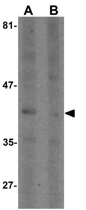 WB analysis of Raji cell lysate in (A) the absence and (B) the presence of blocking peptide using GTX31484 SEPT1 antibody. Working concentration : 1 microg/ml