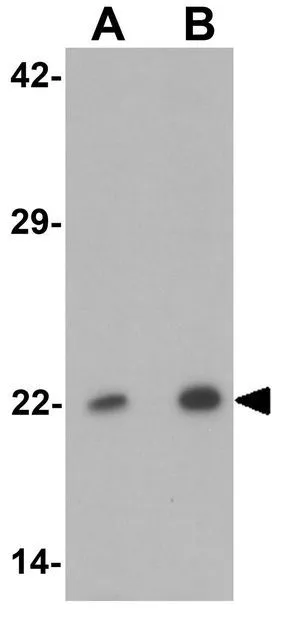 WB analysis of 293 cell lysate using GTX31486 PHOX2B antibody. Working concentration : (A) 1 and (B) 2 microg/ml WB analysis of 293 cell lysate using GTX31486 PHOX2B antibody. Working concentration : (A) 1 and (B) 2 microg/ml