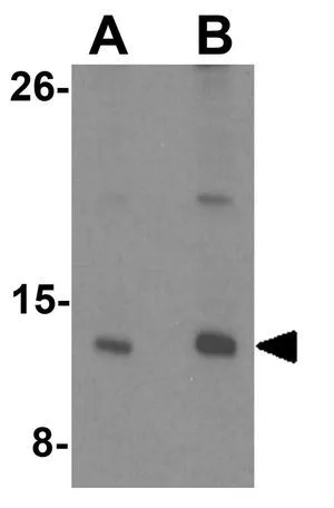 WB analysis of HeLa cell lysate using GTX31488 CENPW antibody. Working concentration : (A) 0.5 and (B) 1 microg/ml WB analysis of HeLa cell lysate using GTX31488 CENPW antibody. Working concentration : (A) 0.5 and (B) 1 microg/ml
