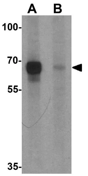 WB analysis of rat lung tissue lysate in (A) the absence and (B) the presence of blocking peptide using GTX31491 BCL6 antibody. Working concentration : 1 microg/ml WB analysis of rat lung tissue lysate in (A) the absence and (B) the presence of blocking peptide using GTX31491 BCL6 antibody. Working concentration : 1 microg/ml