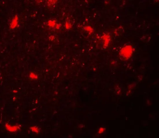 IHC-P analysis of human brain tissue using GTX31493 CBX4 antibody. Working concentration : 20 microg/ml IHC-P analysis of human brain tissue using GTX31493 CBX4 antibody. Working concentration : 20 microg/ml