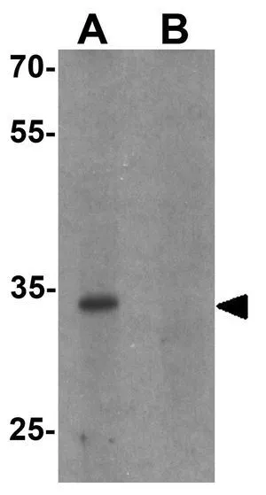 WB analysis of human brain tissue lysate in (A) the absence and (B) the presence of blocking peptide using GTX31493 CBX4 antibody. Working concentration : 1 microg/ml