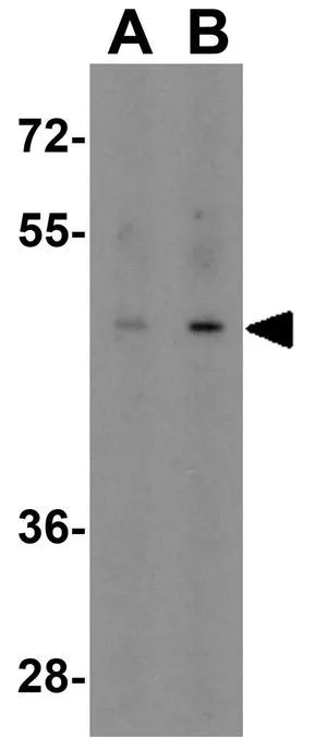 WB analysis of human heart tissue lysate using GTX31494 EED antibody. Working concentration : (A) 1 and (B) 2 microg/ml