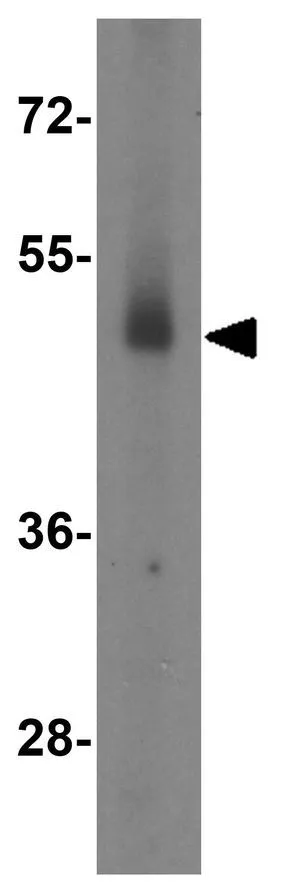WB analysis of human testis tissue lysate using GTX31494 EED antibody. Working concentration : 2 microg/ml