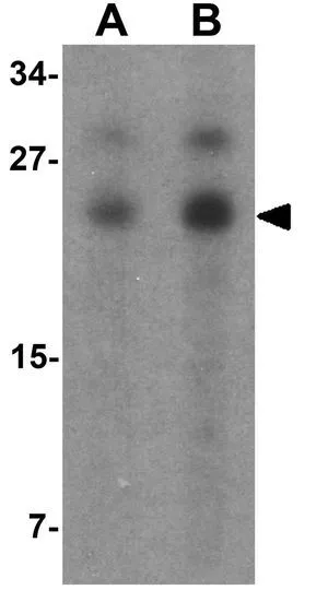 WB analysis of SW480 cell lysate using GTX31495 Laforin antibody. Working concentration : (A) 1 and (B) 2 ug/ml