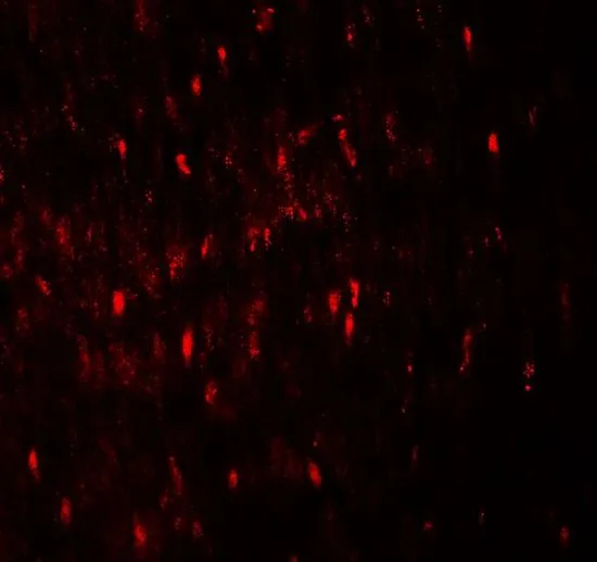 IHC-P analysis of human colon tissue using GTX31497 WIPI1 antibody. Working concentration : 20 microg/ml IHC-P analysis of human colon tissue using GTX31497 WIPI1 antibody. Working concentration : 20 microg/ml