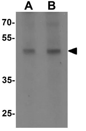 WB analysis of rat colon tissue lysate using GTX31497 WIPI1 antibody. Working concentration : (A) 1 and (B) 2 microg/ml