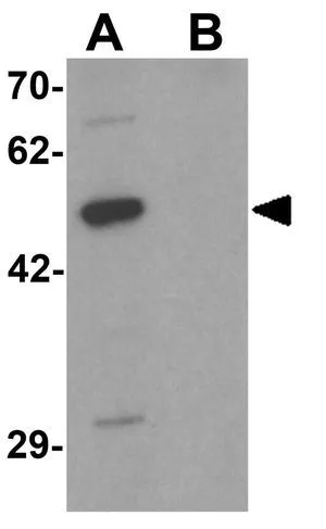 WB analysis of 293 cell lysate in (A) the absence and (B) the presence of blocking peptide using GTX31499 DCP2 antibody. Working concentration : 1 microg/ml
