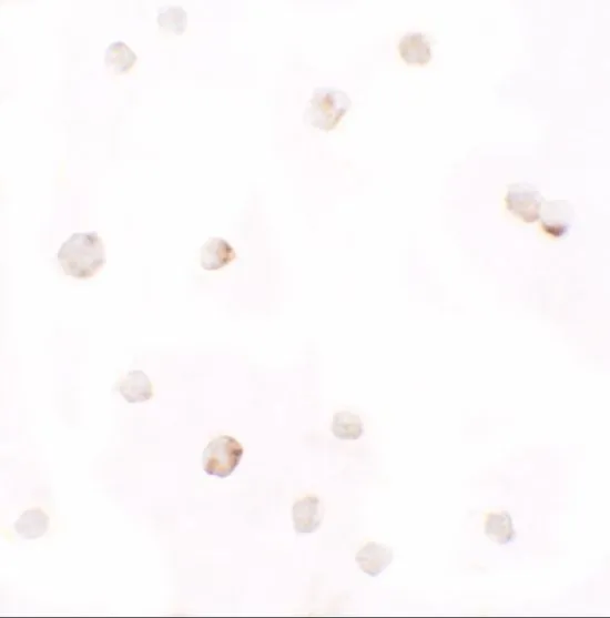 ICC/IF analysis of HepG2 cells using GTX31504 Pellino1 antibody. Working concentration : 2.5 microg/ml ICC/IF analysis of HepG2 cells using GTX31504 Pellino1 antibody. Working concentration : 2.5 microg/ml