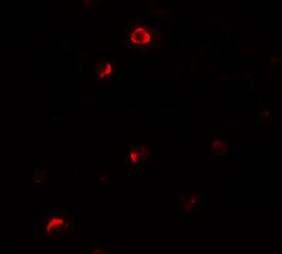 ICC/IF analysis of HepG2 cells using GTX31504 Pellino1 antibody. Working concentration : 20 microg/ml