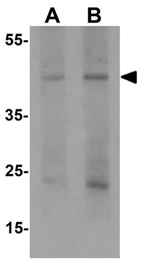 WB analysis of human liver tissue lysate using GTX31504 Pellino1 antibody. Working concentration : (A) 1 and (B) 2 microg/ml
