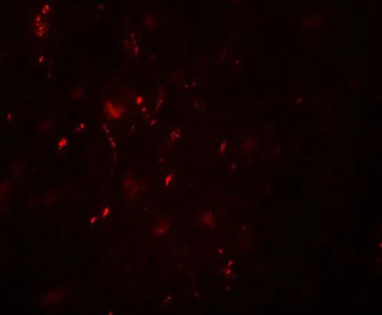 IHC-P analysis of human brain tissue using GTX31506 Brn2 antibody. Working concentration : 20 microg/ml IHC-P analysis of human brain tissue using GTX31506 Brn2 antibody. Working concentration : 20 microg/ml