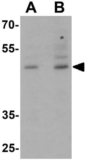 WB analysis of 3T3 cell lysate using GTX31506 Brn2 antibody. Working concentration : (A) 1 and (B) 2 microg/ml