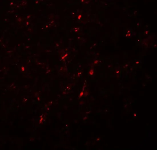 IHC-P analysis of human brain tissue using GTX31509 Neurogenin 2 antibody. Working concentration : 20 microg/ml IHC-P analysis of human brain tissue using GTX31509 Neurogenin 2 antibody. Working concentration : 20 microg/ml
