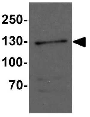 WB analysis of EL4 cell lysate using GTX31512 FMNL1 antibody. Working concentration : 1 microg/ml