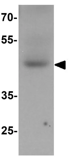 WB analysis of human testis tissue lysate using GTX31513 WIPI2 antibody. Working concentration : 1 microg/ml WB analysis of human testis tissue lysate using GTX31513 WIPI2 antibody. Working concentration : 1 microg/ml