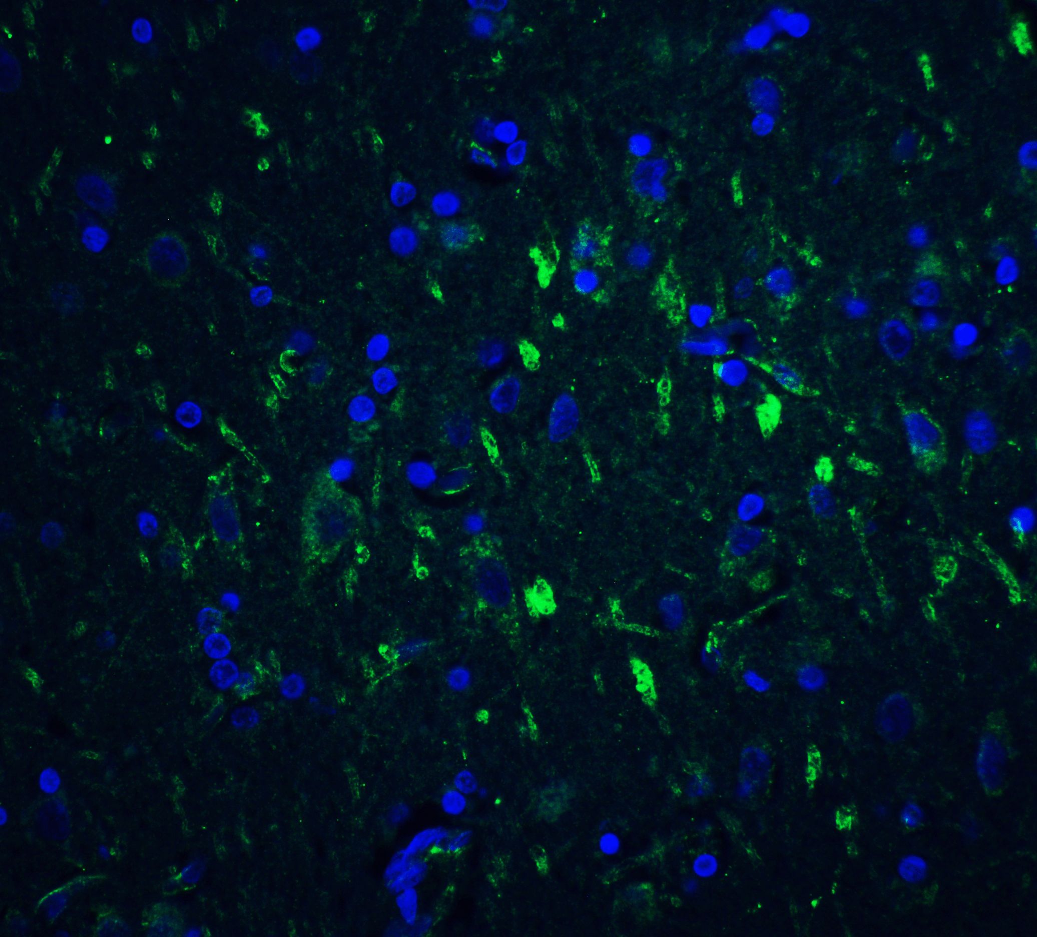 foxp3 antibody foxp3 antibody