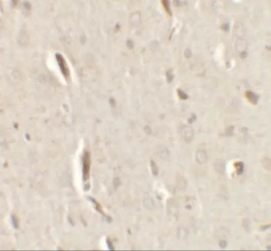 IHC-P analysis of rat brain tissue using GTX31521 GRIP1 antibody. Working concentration : 2.5 microg/ml IHC-P analysis of rat brain tissue using GTX31521 GRIP1 antibody. Working concentration : 2.5 microg/ml