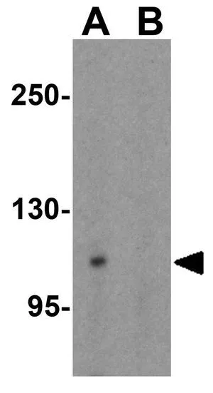 WB analysis of 293 cell lysate in (A) the absence and (B) the presence of blocking peptide using GTX31521 GRIP1 antibody. Working concentration : 1 microg/ml