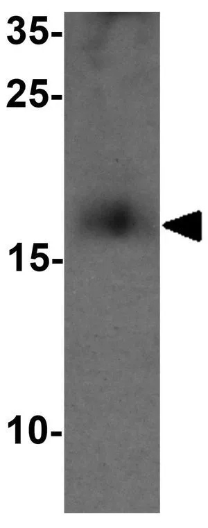WB analysis of mouse spleen tissue lysate using GTX31524 CD59 antibody. Working concentration : 1 microg/ml WB analysis of mouse spleen tissue lysate using GTX31524 CD59 antibody. Working concentration : 1 microg/ml
