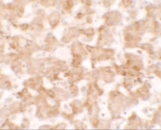IHC-P analysis of human liver tissue using GTX31532 TMEM135 antibody. Working concentration : 2.5 microg/ml IHC-P analysis of human liver tissue using GTX31532 TMEM135 antibody. Working concentration : 2.5 microg/ml