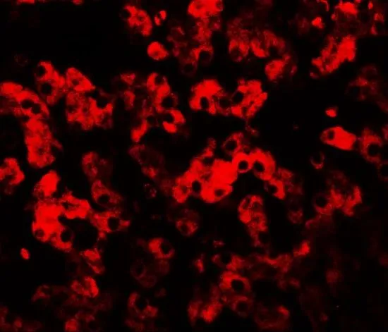 IHC-P analysis of human liver tissue using GTX31532 TMEM135 antibody. Working concentration : 20 microg/ml