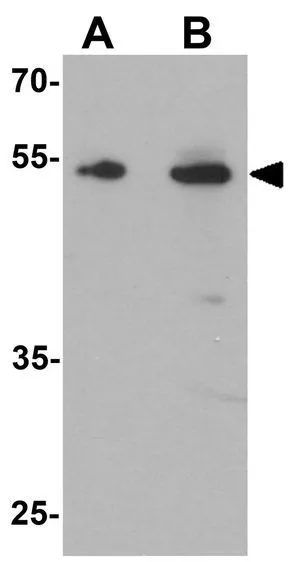 WB analysis of rat liver tissue lysate using GTX31532 TMEM135 antibody. Working concentration : (A) 1 and (B) 2 microg/ml
