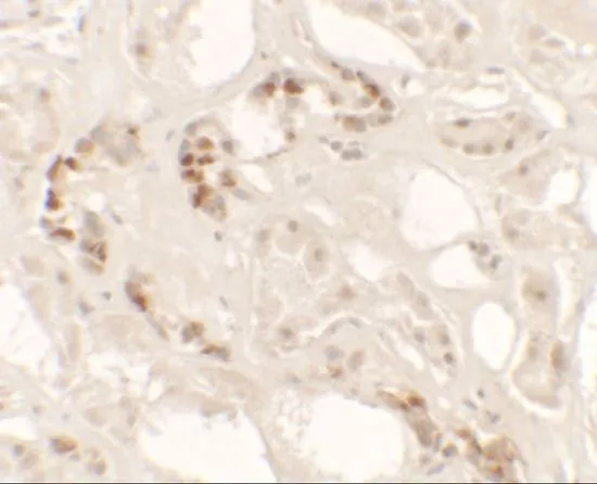 IHC-P analysis of human kidney tissue using GTX31536 KANK2 antibody. Working concentration : 2.5 microg/ml IHC-P analysis of human kidney tissue using GTX31536 KANK2 antibody. Working concentration : 2.5 microg/ml