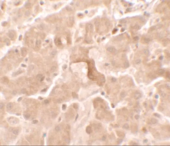 IHC-P analysis of human liver tissue using GTX31537 GBP5 antibody. Working concentration : 2.5 microg/ml IHC-P analysis of human liver tissue using GTX31537 GBP5 antibody. Working concentration : 2.5 microg/ml
