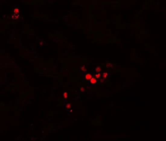 IHC-P analysis of human liver tissue using GTX31537 GBP5 antibody. Working concentration : 20 microg/ml