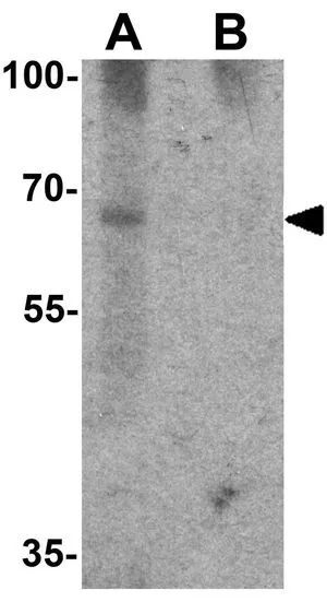 WB analysis of rat liver tissue lysate in (A) the absence and (B) the presence of blocking peptide using GTX31537 GBP5 antibody. Working concentration : 1 microg/ml