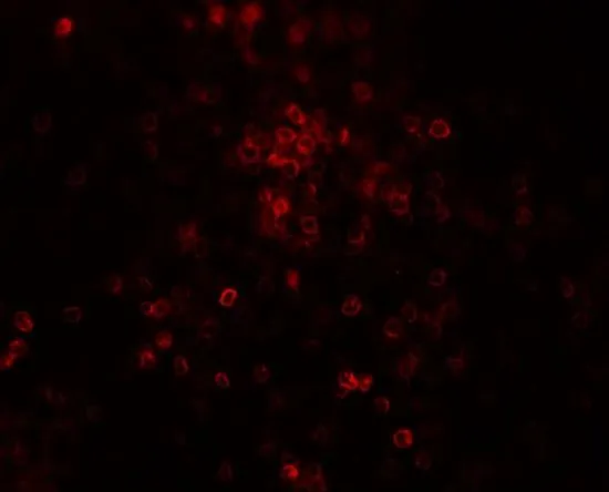 IHC-P analysis of human spleen tissue using GTX31542 TLX3 antibody. Working concentration : 20 microg/ml