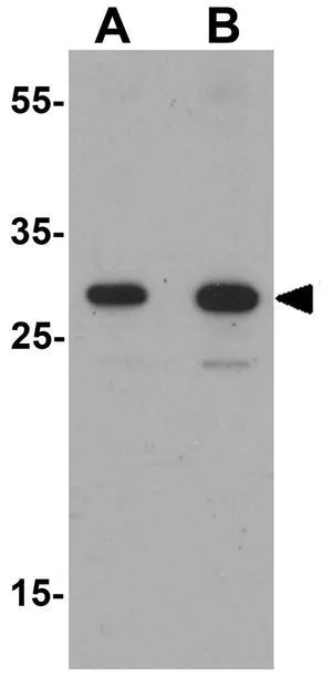 WB analysis of human spleen tissue lysate using GTX31542 TLX3 antibody. Working concentration : (A) 0.5 and (B) 1 microg/ml