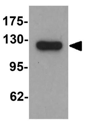 WB analysis of K562 cell lysate using GTX31547 Lipin 1 antibody. Working concentration : 1 microg/ml
