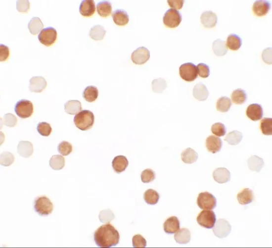 ICC/IF analysis of HeLa cells using GTX31548 CBP80 antibody. Working concentration : 2.5 microg/ml ICC/IF analysis of HeLa cells using GTX31548 CBP80 antibody. Working concentration : 2.5 microg/ml