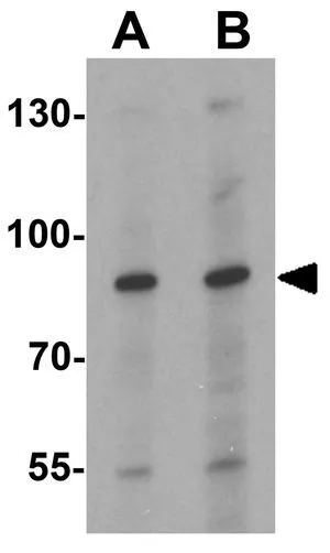 WB analysis of HeLa cell lysate using GTX31548 CBP80 antibody. Working concentration : (A) 1 and (B) 2 microg/ml
