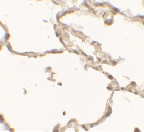IHC-P analysis of human lung tissue using GTX31550 DOPA Decarboxylase antibody. Working concentration : 2.5 microg/ml IHC-P analysis of human lung tissue using GTX31550 DOPA Decarboxylase antibody. Working concentration : 2.5 microg/ml
