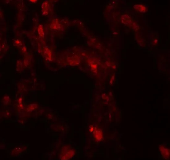 IHC-P analysis of human lung tissue using GTX31550 DOPA Decarboxylase antibody. Working concentration : 20 microg/ml