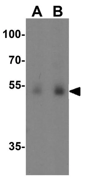 WB analysis of human lung tissue lysate using GTX31550 DOPA Decarboxylase antibody. Working concentration : (A) 0.5 and (B) 1 microg/ml