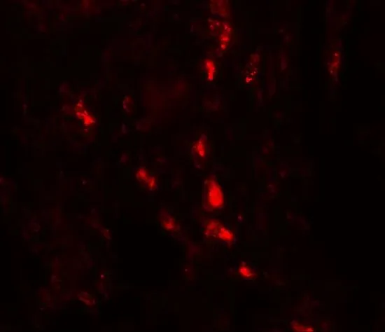 IHC-P analysis of human lung tissue using GTX31552 ARSB antibody. Working concentration : 20 microg/ml