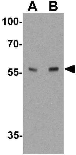 WB analysis of mouse lung tissue lysate using GTX31552 ARSB antibody. Working concentration : (A) 1 and (B) 2 microg/ml