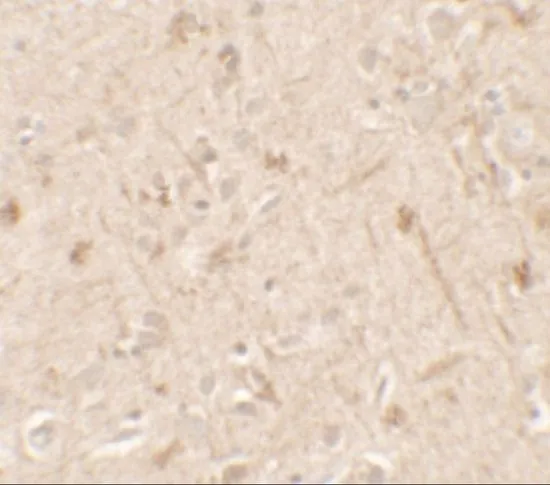 IHC-P analysis of human brain tissue using GTX31555 IL1F6 antibody. Working concentration : 5 microg/ml IHC-P analysis of human brain tissue using GTX31555 IL1F6 antibody. Working concentration : 5 microg/ml