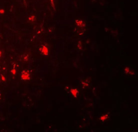 IHC-P analysis of human brain tissue using GTX31555 IL1F6 antibody. Working concentration : 20 microg/ml