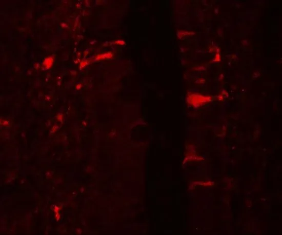 IHC-P analysis of rat small intestine tissue using GTX31556 IL1F5 antibody. Working concentration : 20 microg/ml