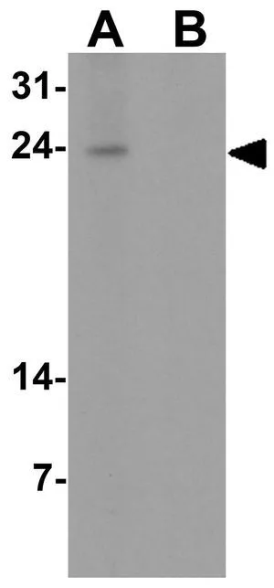 WB analysis of human spleen tissue lysate in (A) the absence and (B) the presence of blocking peptide using GTX31556 IL1F5 antibody. Working concentration : 1 microg/ml