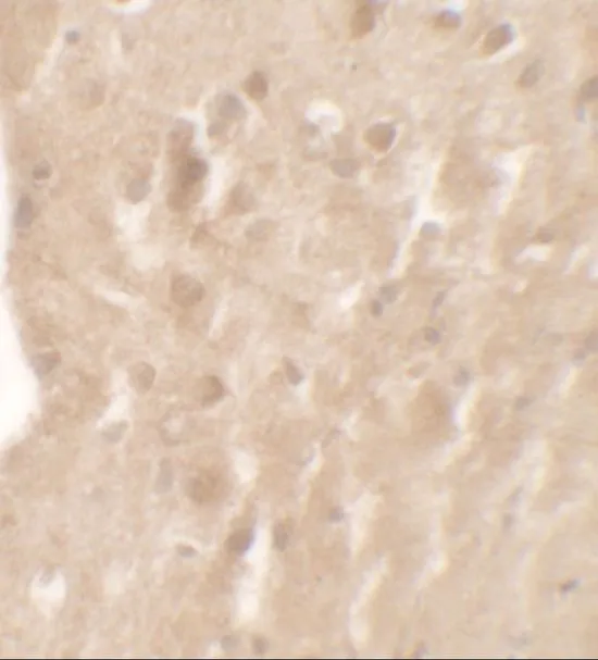IHC-P analysis of mouse brain tissue using GTX31557 AIMP1 antibody. Working concentration : 5 microg/ml IHC-P analysis of mouse brain tissue using GTX31557 AIMP1 antibody. Working concentration : 5 microg/ml