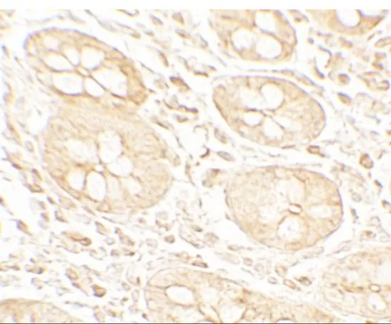 IHC-P analysis of human small intestine tissue using GTX31558 Mist1 antibody. Working concentration : 5 microg/ml IHC-P analysis of human small intestine tissue using GTX31558 Mist1 antibody. Working concentration : 5 microg/ml