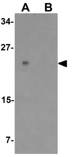 WB analysis of rat small Intestine tissue lysate in (A) the absence and (B) the presence of blocking peptide using GTX31558 Mist1 antibody. Working concentration : 1 microg/ml
